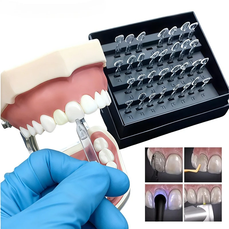 Teeth Whitening Moulds - 복합 레진 라미네이트용 치과 몰드 키트,