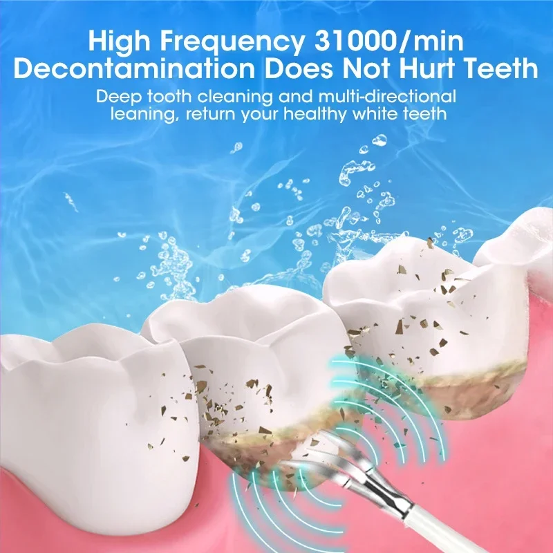 치아 세척용 초음파 스케일러 치석 제거 플라크 제거 충 - Teeth Whitening Mouthwash 리뷰 및 가격