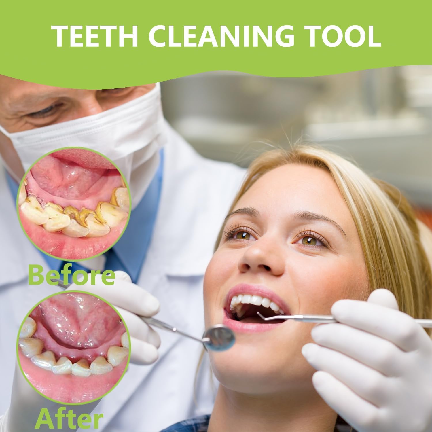 전문 치아 청소 구강 관리 키트, 스테인리스 스틸 치석 - Teeth Whitening Mouthwash 리뷰 및 가격