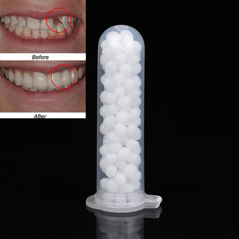 【K】1세트 임시 치아 보수 키트, 치아 및 치아 간격 - Teeth Whitening Kit 리뷰 및 가격