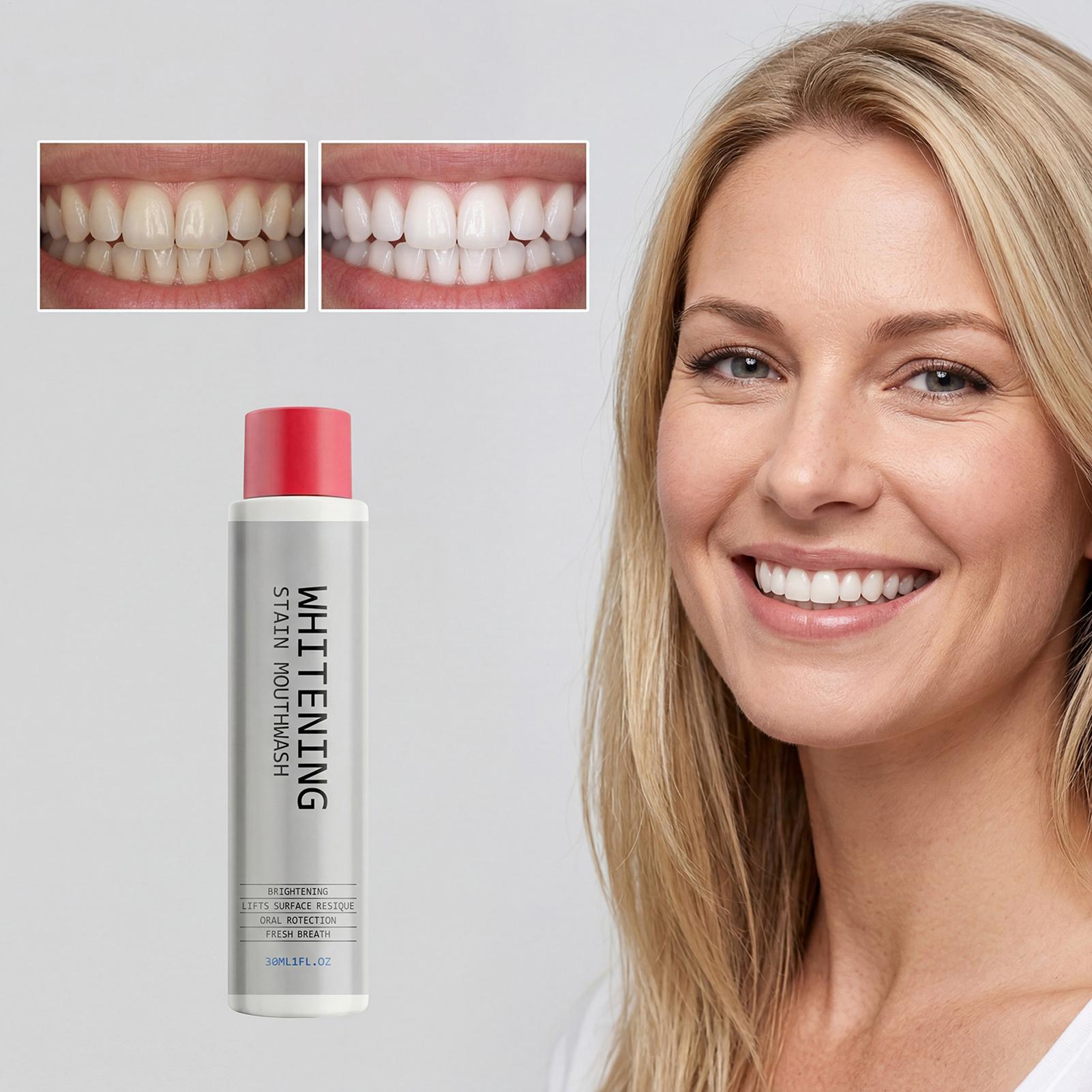 30ml 얼룩 제거 구강청결제, 냄새 제거, 치아 미백 - Teeth Whitening Mouthwash 리뷰 및 가격